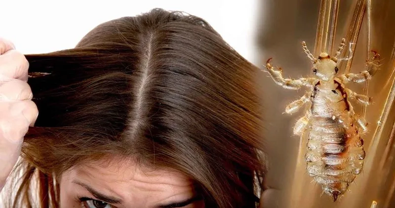 Kính hiển vi xem chấy