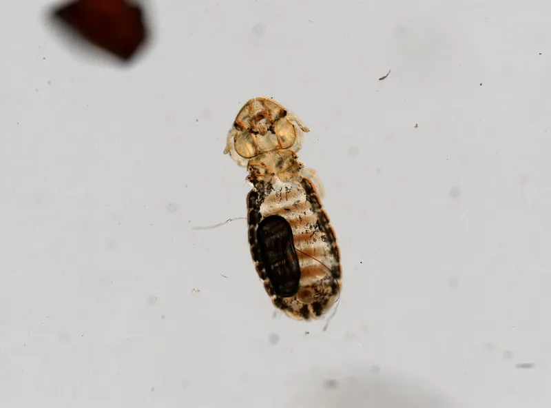 Độ phóng đại xem chấy (thường là 40x)