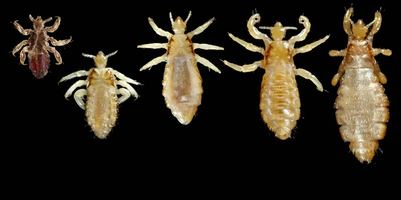 Chấy rận trên người ra sao 