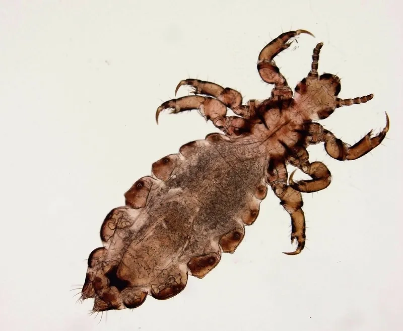 Chấy là con gì (côn trùng ký sinh)