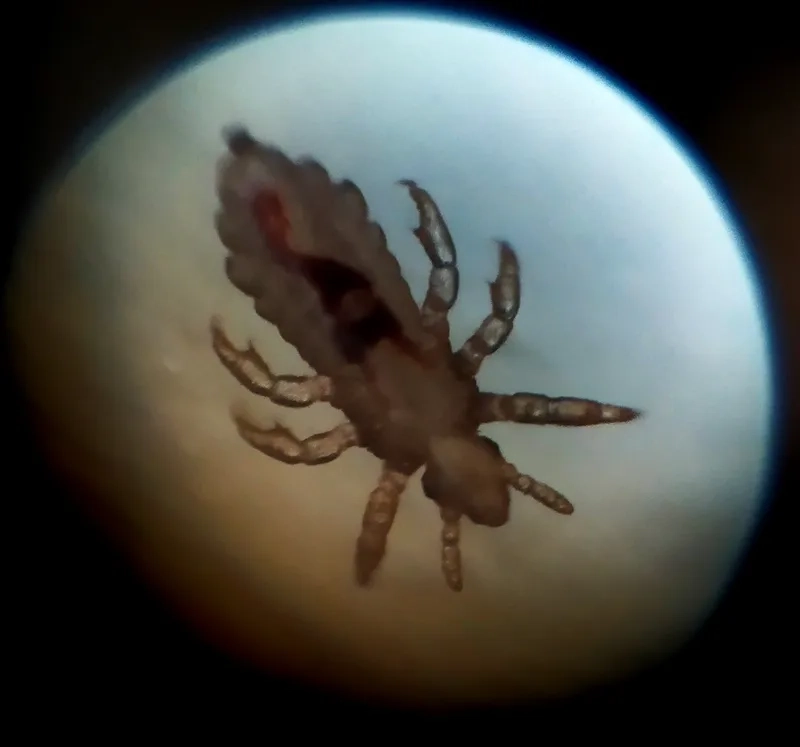 Con chí dưới kính hiển vi