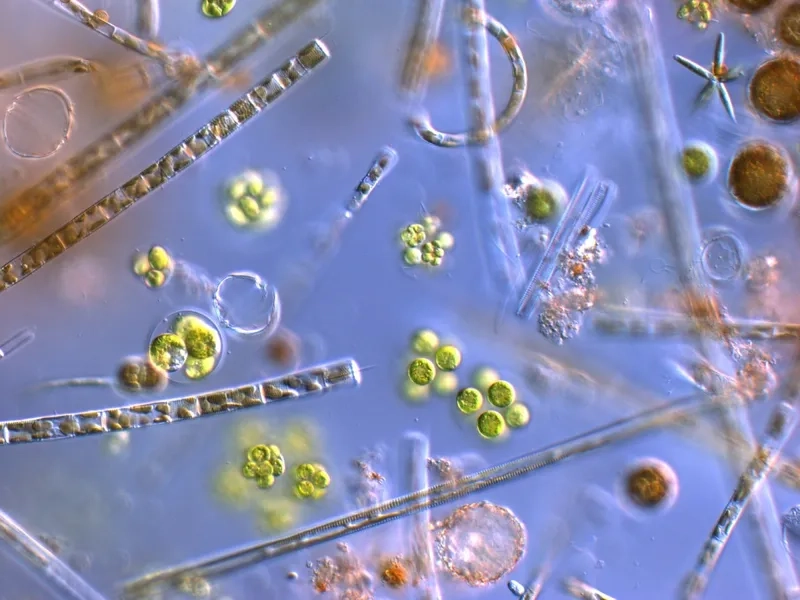 Luân trùng dưới kính hiển vi với vành lông