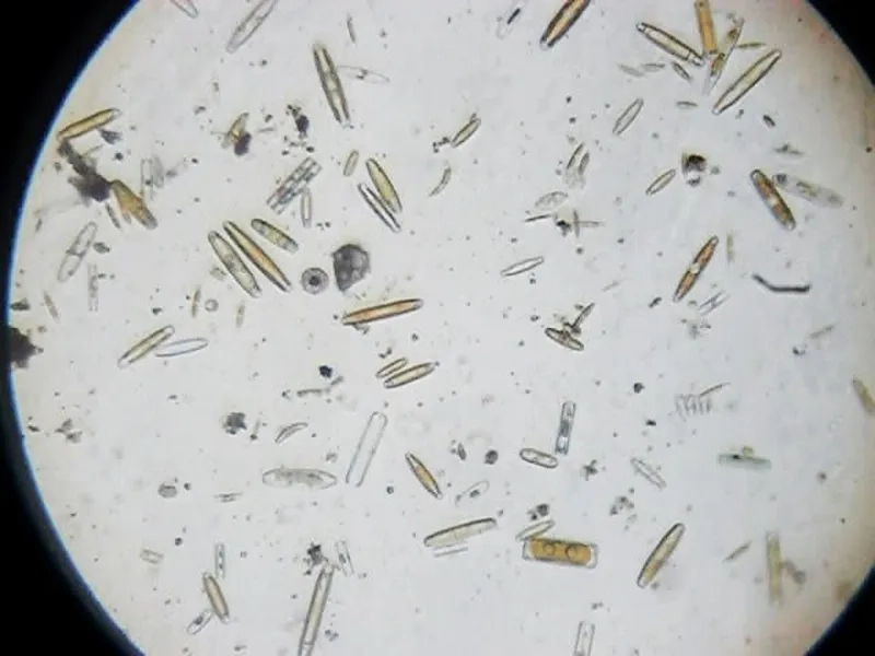 Nước bẩn dưới kính hiển vi có nhiều vi khuẩn
