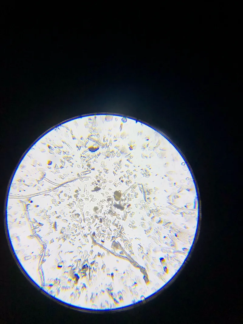 Vi tảo trong nước hồ tạo nên chuỗi thức ăn