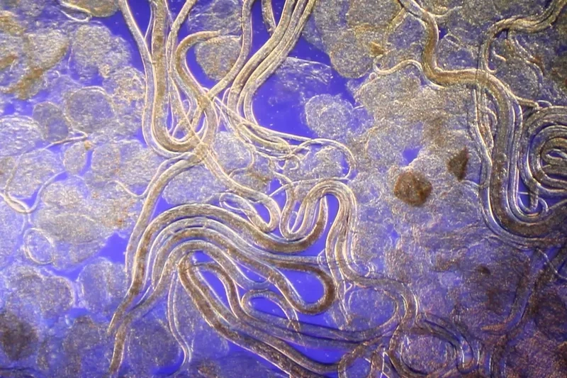 Vi khuẩn nước cần độ phóng đại cao