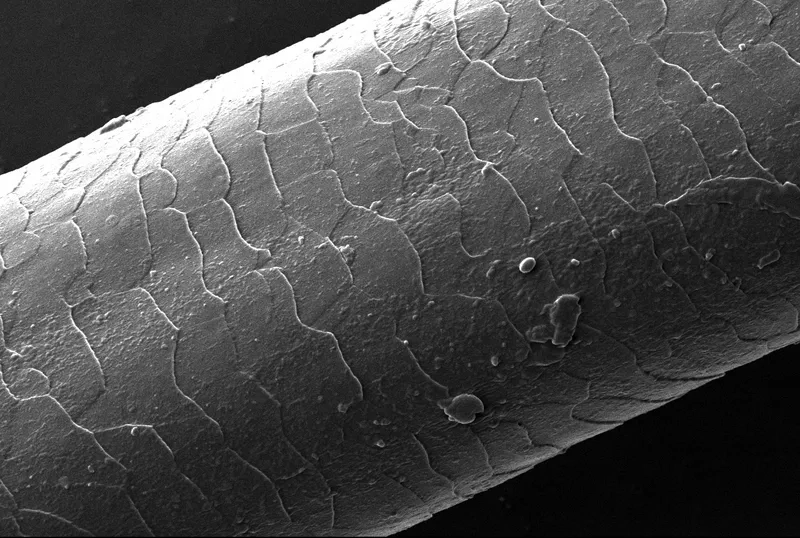 Lỗ chân lông dưới kính hiển vi