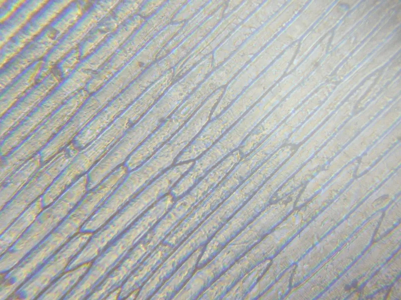 Nhân tế bào hành tây nằm ở giữa