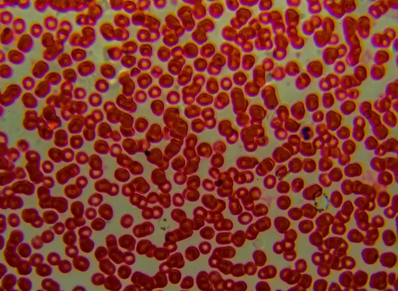 Bạch cầu dưới kính hiển vi lớn hơn hồng cầu