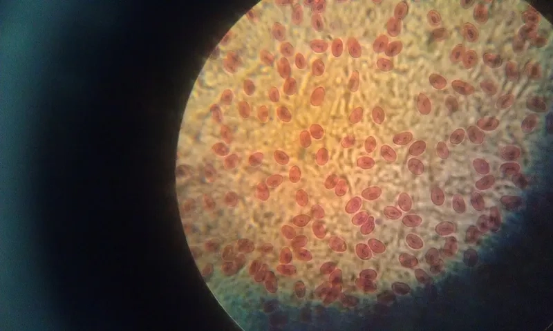 Ảnh máu ngoại vi được lấy từ tĩnh mạch