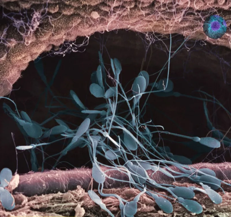 Tinh trùng dưới kính hiển vi hình dạng độc đáo