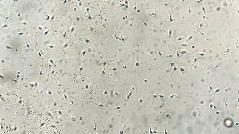 Tinh trùng dị dạng đầu hoặc đuôi bất thường