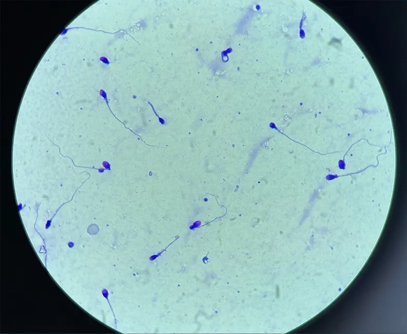 Tinh trùng và thụ tinh trong ống nghiệm