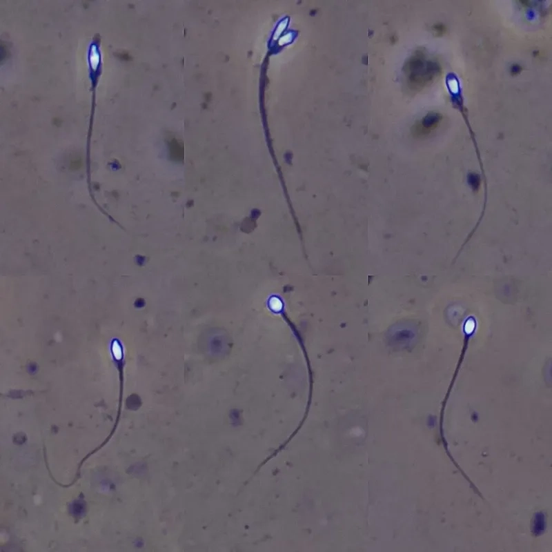 Tinh trùng sống sót sau quá trình rửa