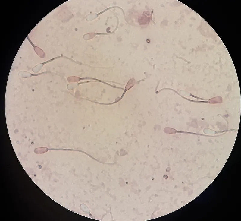 Tốc độ di chuyển tinh trùng được ghi lại