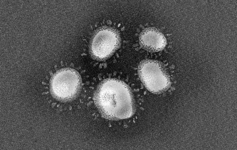 Biến thể Delta dưới kính hiển vi