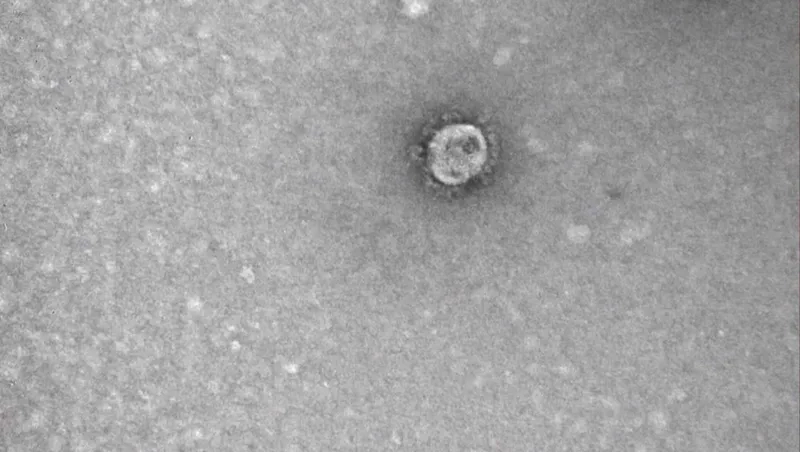Độ phóng đại virus corona (hàng triệu lần)