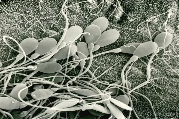 Tinh trùng dưới kính hiển vi hé lộ chất lượng sinh sản