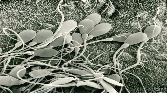 Tinh trùng dưới kính hiển vi hé lộ chất lượng sinh sản