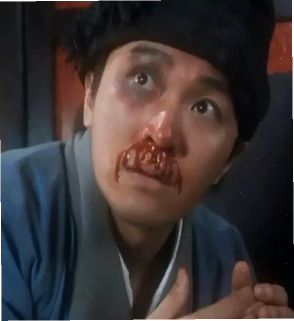 Meme chảy máu mũi